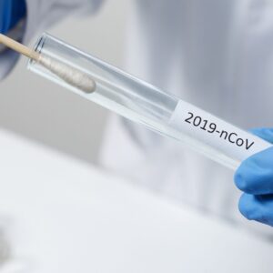 Non-Vaccinated Day 2&8 PCR